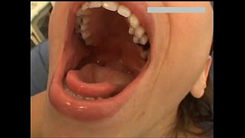 Girl Throat Gagging Vomit Puke Puking Vomiting And Barf free video